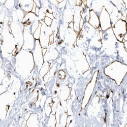 ECM2 Antibody, Novus Biologicals 0.1mL; Unlabeled:Antibodies, Polyclonal
